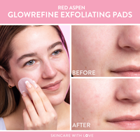 GlowRefine Exfoliating Pads
