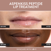 AspenKiss Peptide Lip Treatment