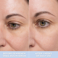 DewRenew Snail Mucin Serum