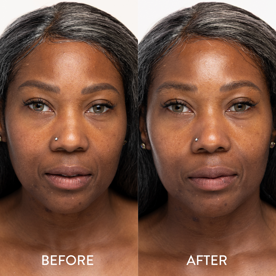 Blue Hydrogel Face Mask