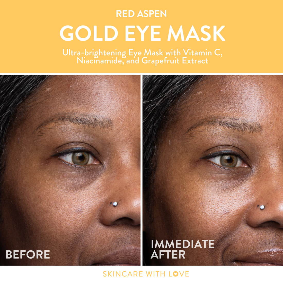 Gold Eye Mask - 5 Pack