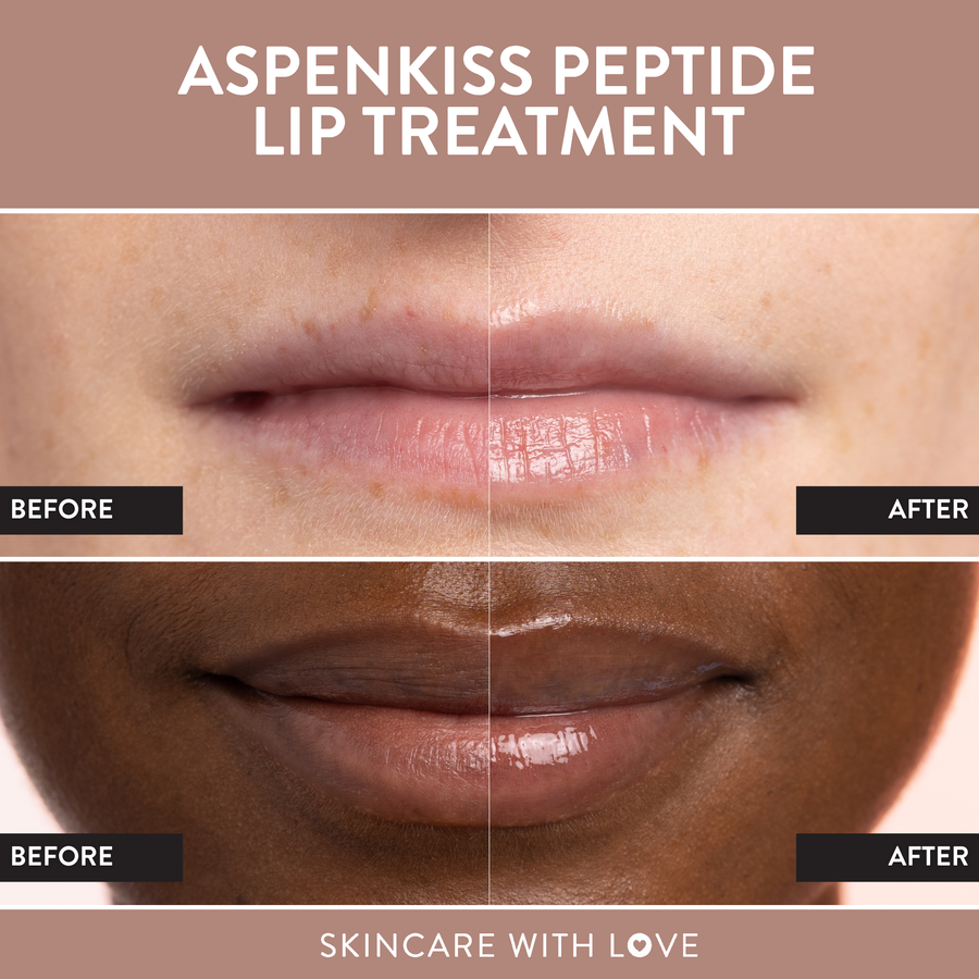 AspenKiss Peptide Lip Treatment