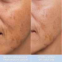DewRenew Snail Mucin Serum