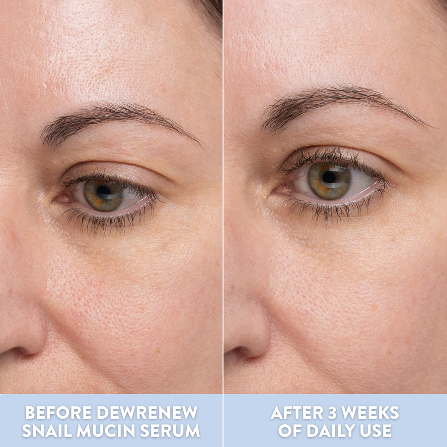 DewRenew Snail Mucin Serum