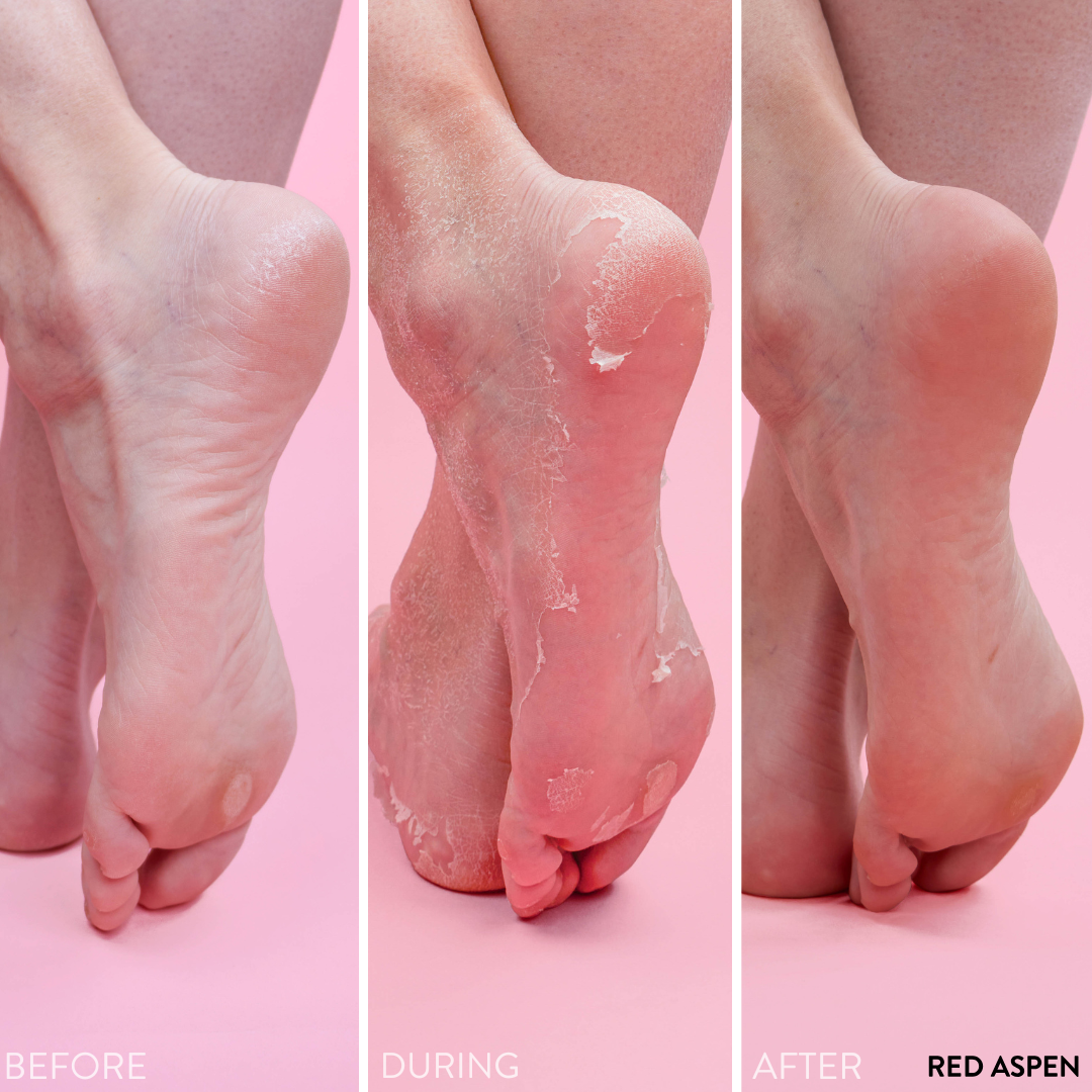 PediExfoliate Foot Peeling Mask