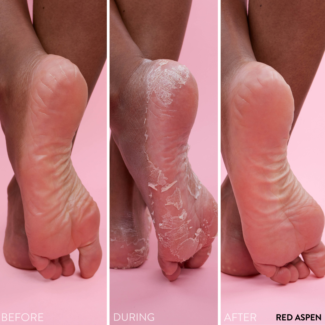PediExfoliate Foot Peeling Mask